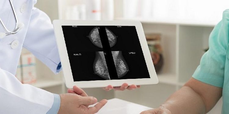 Mamografinizin sonucunun şüpheli olması ne anlama gelir?